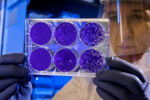 Scientist examines the result of a plaque assay